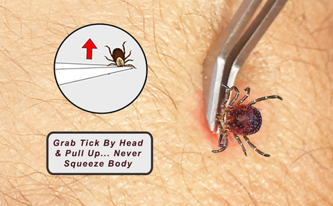 Image of Tick Remover Tick-Off - Hygienic All Stainless Steel Tick Removal Tool With Leather Case. Complete With Tick Removal Instructions & Identification Chart - Patent No. D889,646