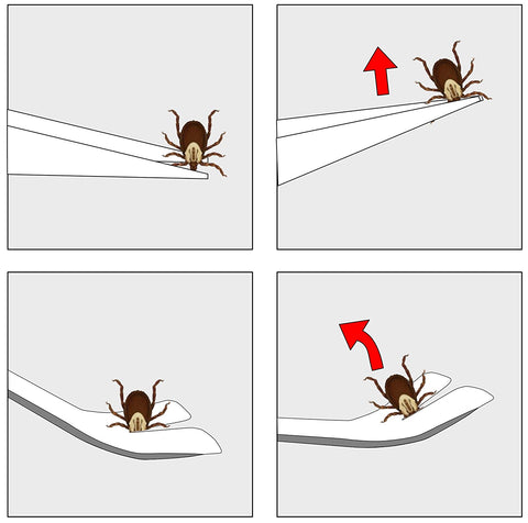 Image of Tick Remover Tick-Off - Hygienic All Stainless Steel Tick Removal Tool With Leather Case. Complete With Tick Removal Instructions & Identification Chart - Patent No. D889,646