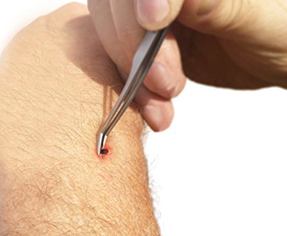 Image of Tick Remover Tick-Off - Hygienic All Stainless Steel Tick Removal Tool With Leather Case. Complete With Tick Removal Instructions & Identification Chart - Patent No. D889,646